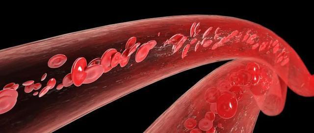 博鱼3招自测你的血管“年轻”吗？常吃这些食物让血管“逆生长”！(图8)